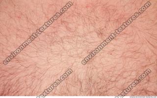 Photo Textures of Human Skin